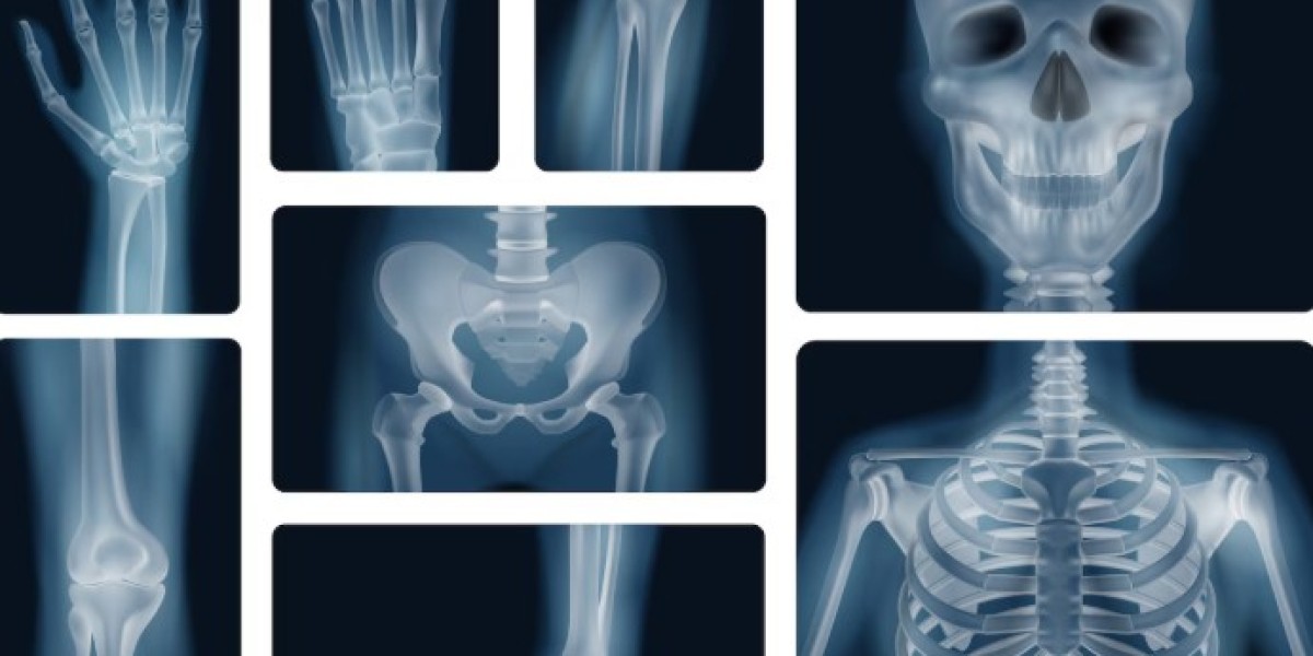 X-Ray in Dubai for Bone Injuries: What to Expect and Where to Go