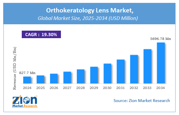 Orthokeratology Lens Market Size, Growth, Forecast | Industry Trends [2034]