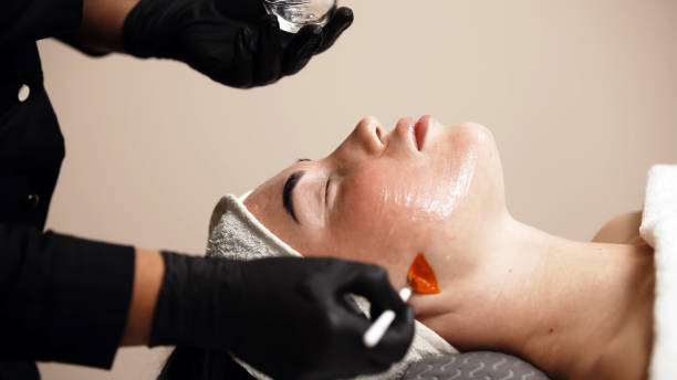 Can Clinical Treatments Help Fade Pigmentation and Dark Spots?