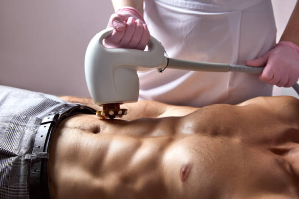 Who Is an Ideal Candidate for Laser Body Sculpting?