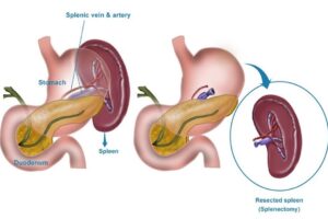 My Real Review On Synadentix — After 3 Months of Use