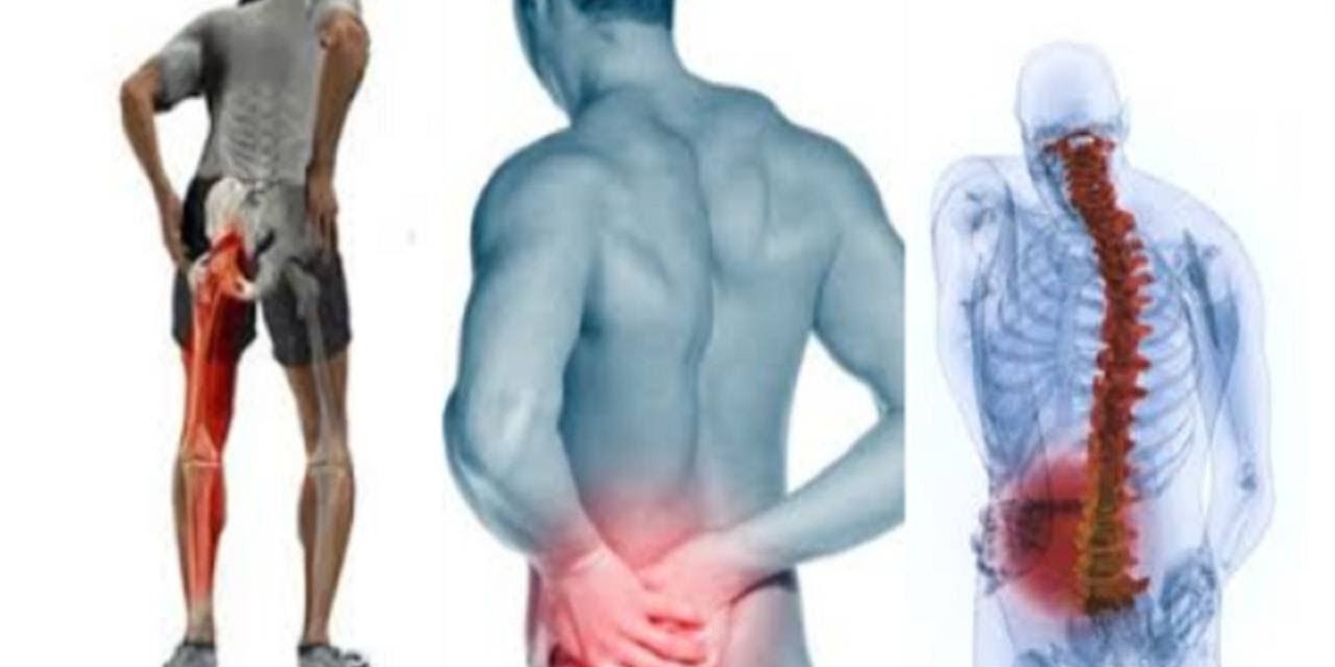 Sciatica Pain in Dallas: Symptoms, Causes, and Treatment Options