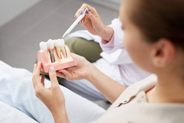 The Biggest Mistakes Patients Make Before Getting Dental Implants – Telegraph